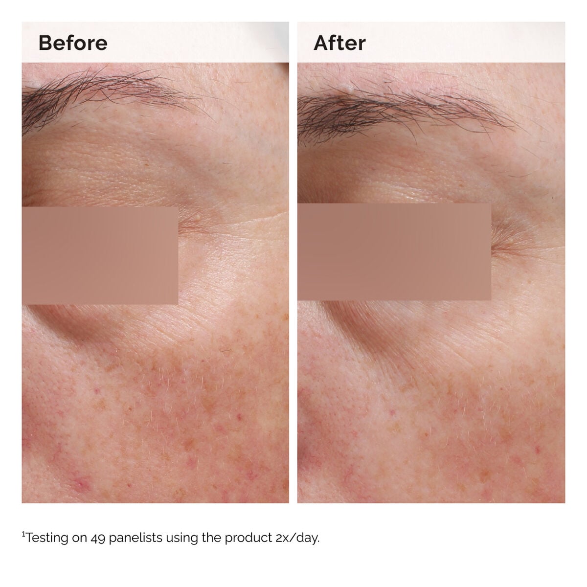 niacinamide-5-face-and-body-emulsion-d0 2024-08-23-ORD-Nia-5pct-Face-Body-B-A-Elasticity-Global-02-1x1.jpg
