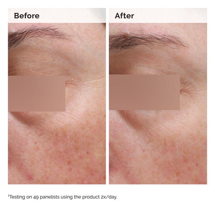 niacinamide-5-face-and-body-emulsion-d0 2024-08-23-ORD-Nia-5pct-Face-Body-B-A-Elasticity-Global-02-1x1.jpg