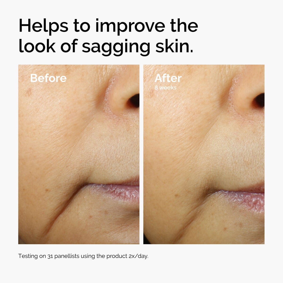 caffeine-3-escin-1-face-serum-v8 ord-caffeine-3pct-escin-1pct-face-serum-before-after-sagging.jpg