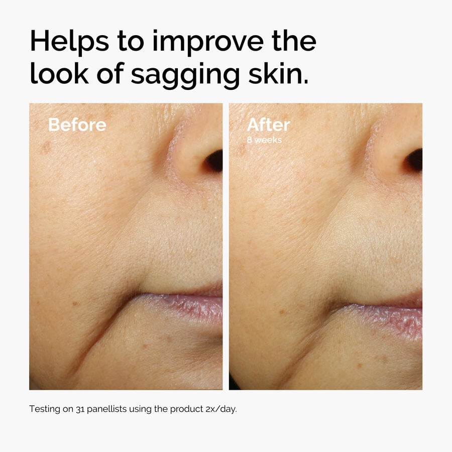 caffeine-3-escin-1-face-serum-v8 ord-caffeine-3pct-escin-1pct-face-serum-before-after-sagging.jpg