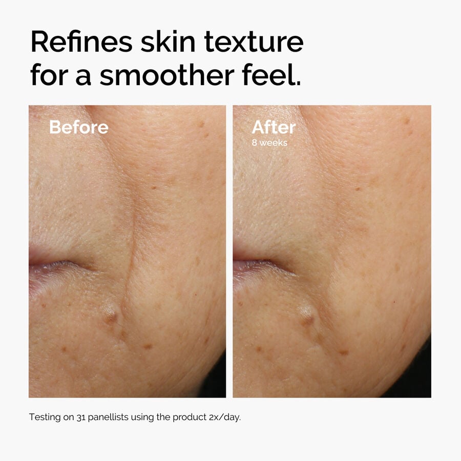 caffeine-3-escin-1-face-serum-v8 ord-caffeine-3pct-escin-1pct-face-serum-before-after-texture.jpg