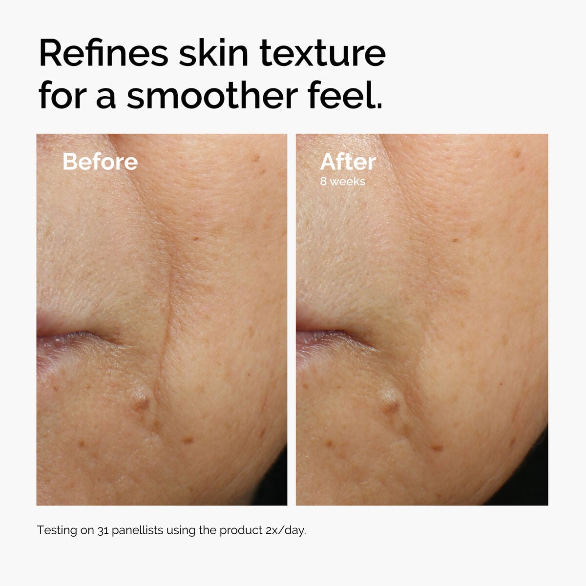 caffeine-3-escin-1-face-serum-v8 ord-caffeine-3pct-escin-1pct-face-serum-before-after-texture.jpg
