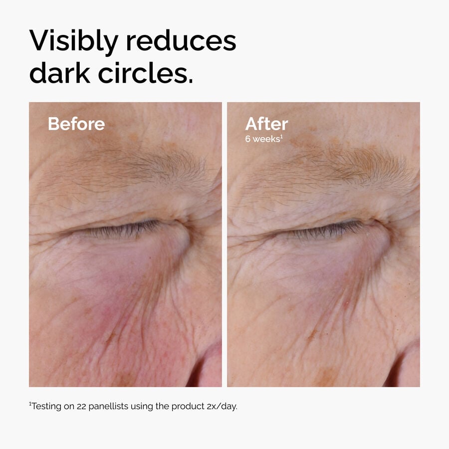 caffeine-solution-5-egcg-eye-serum-n2 ord-caffeine-solution-egcg-dark-circles-before-after.jpg