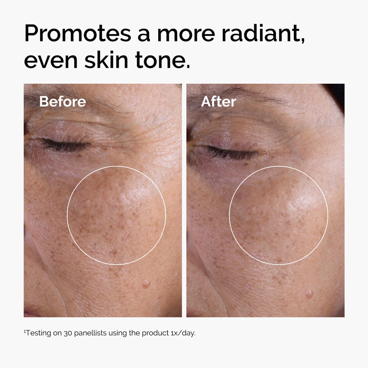 glycolic-acid-7-exfoliating-toner-g7 ord-glycolic-before-after-radiance.jpg