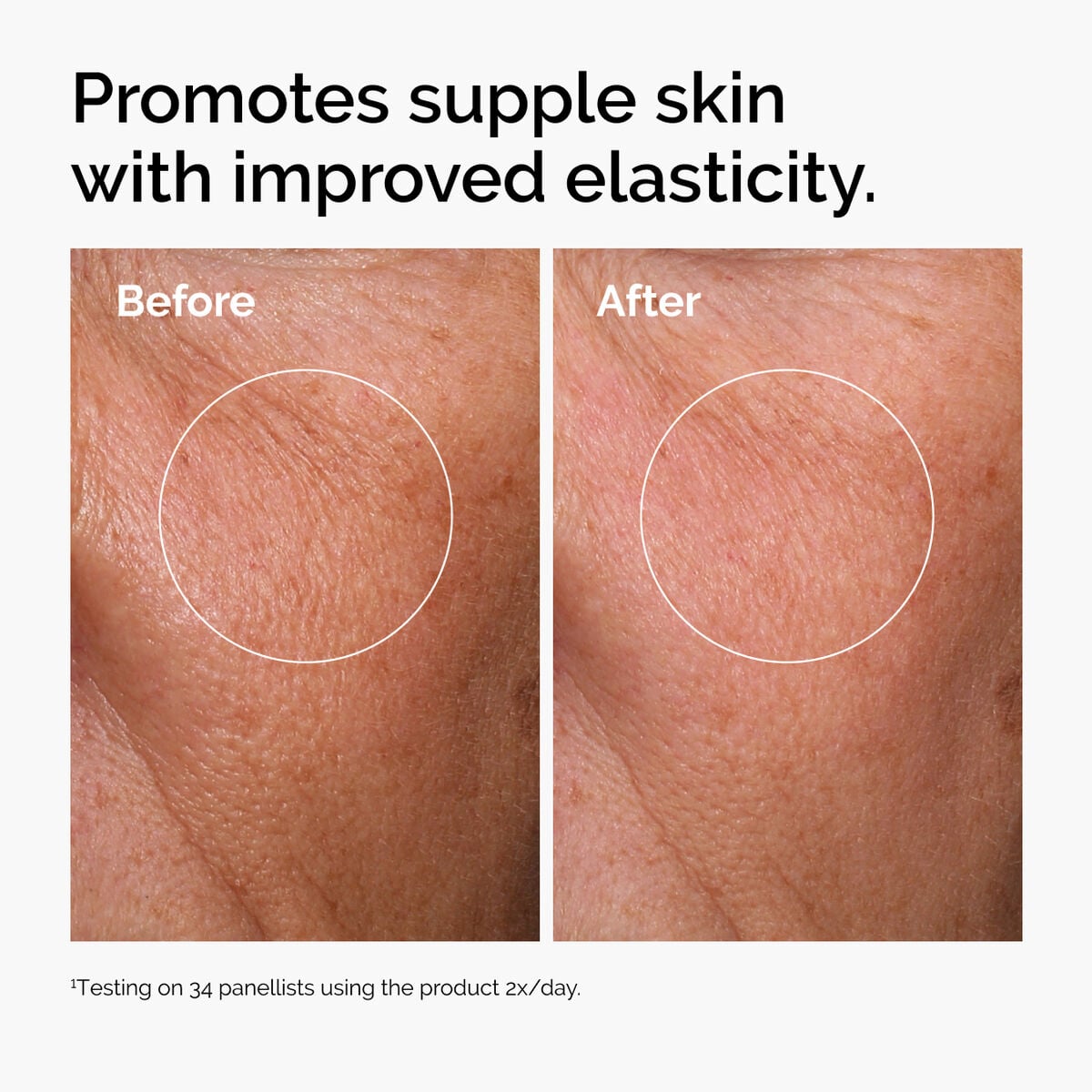 hyaluronic-acid-2-b5-with-ceramides-l4 ord-hyaluronic-acid-2pct-b5-hydrating-serum-before-after-elasticity.jpg