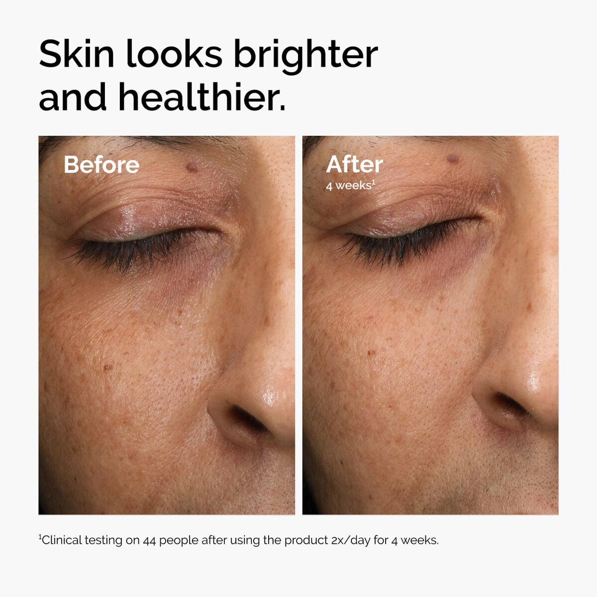 multi-antioxidant-radiance-serum-n2 ord-mars-before-after-healthy.jpg