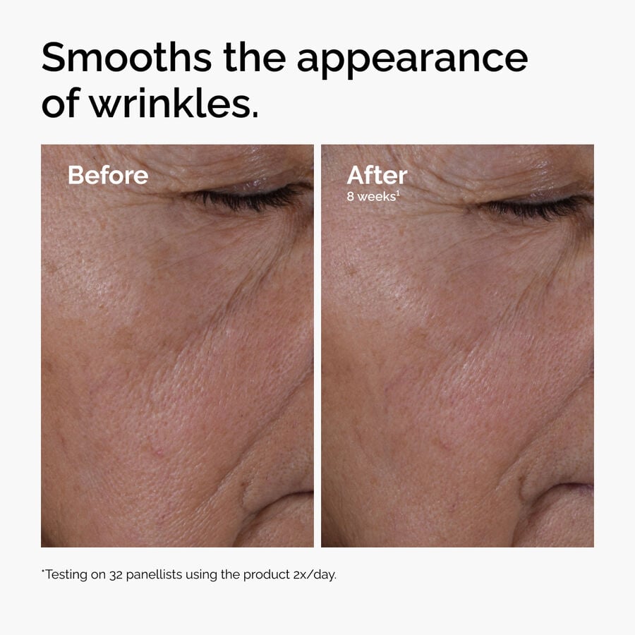 multi-peptide-ha-serum-m1 ord-multi-peptide-ha-serum-wrinkles-before-after.jpg