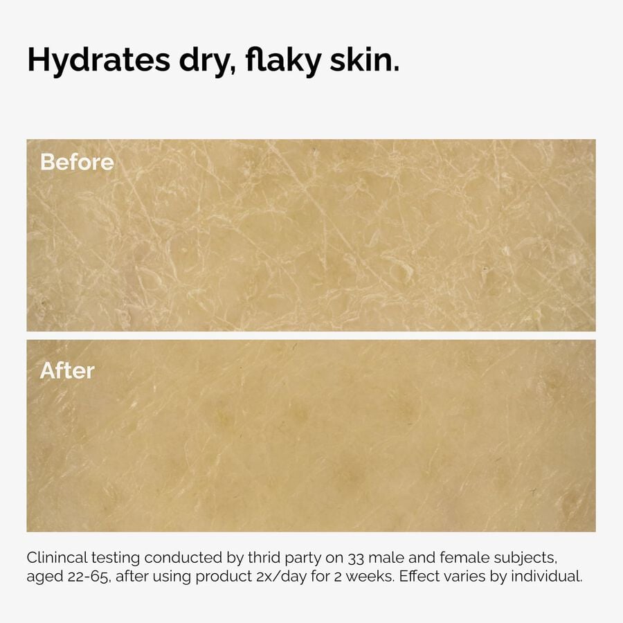 the-body-care-collection-o1 ord-natural-moisturizing-factors-inulin-body-before-after-graphic-02.jpg