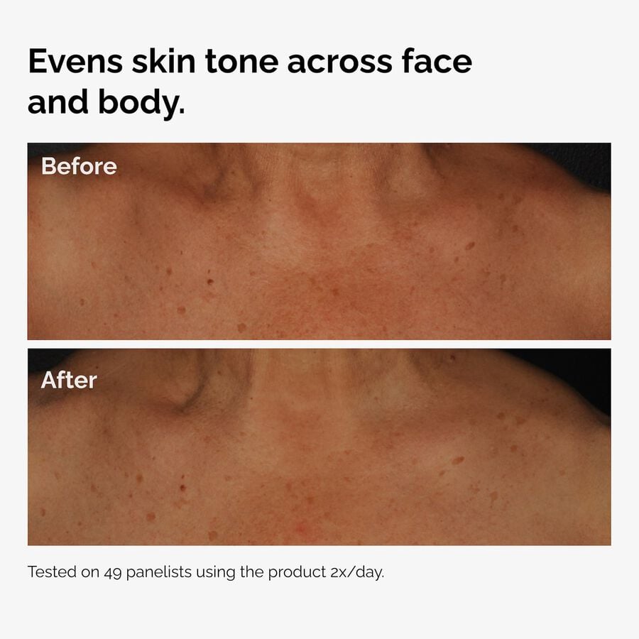 the-body-care-collection-o1 ord-niacinamide-face-body-serum-before-after-even-tone-graphic.jpg