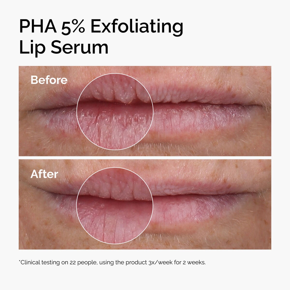pha-5-exfoliating-lip-serum-x0 ord-pha-5pct-lip-exfoliating-serum-before-after.jpg