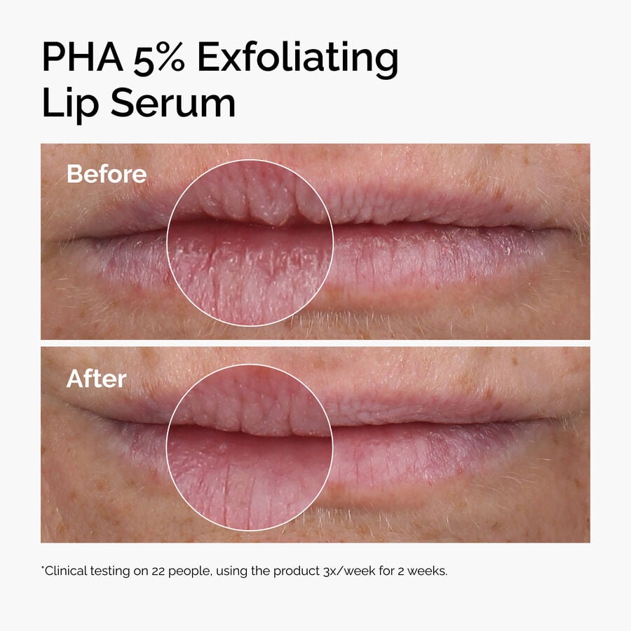 pha-5-exfoliating-lip-serum-x0 ord-pha-5pct-lip-exfoliating-serum-before-after.jpg