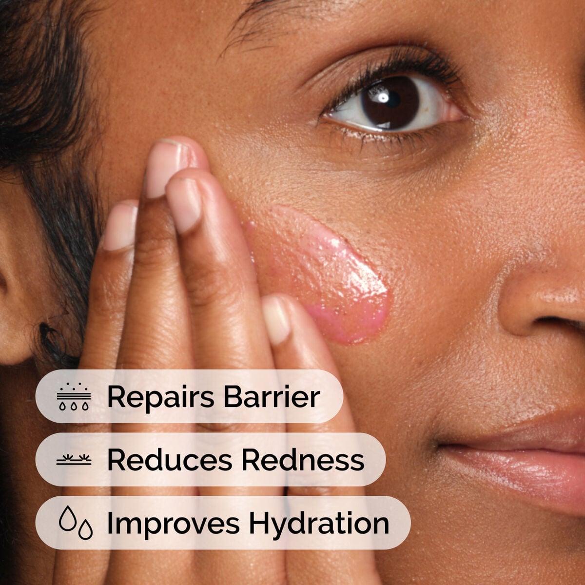 soothing-and-barrier-support-serum-u9 ord-soothing-barrier-support-serum-model-application-with-benefits.jpg