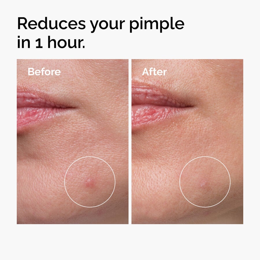 sulfur-10-powder-to-cream-concentrate-g2 ord-sulfur-10pct-powder-to-cream-concentrate-before-after-NA.jpg